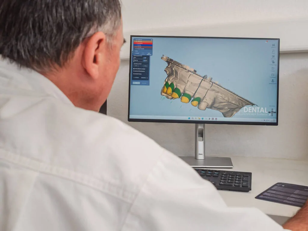 Zahntechniker bei der CAD/CAM-Planung eines Zahnersatzes.